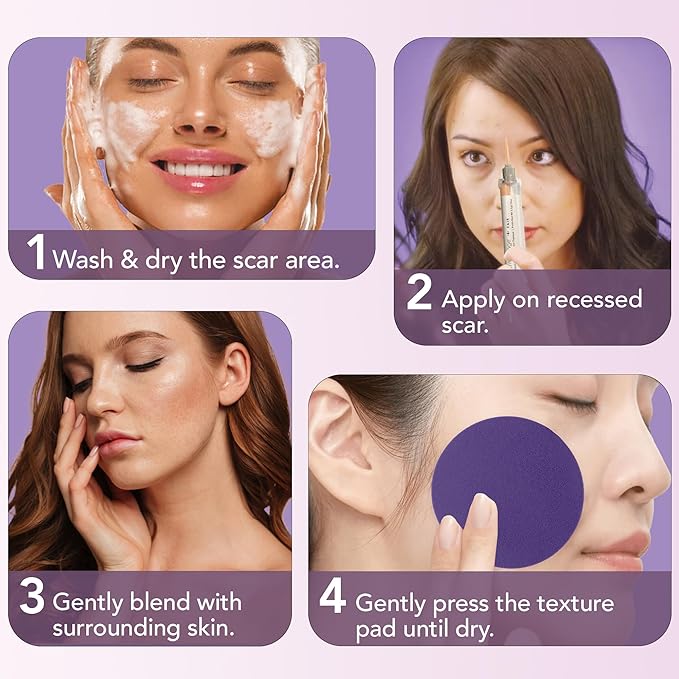 Dermaflage Scar Filler Kit - Medium - Deep Scar Cover and Waterproof Concealer for Acne Scars Wrinkles, and Ice Pick Scars Makeup, 1 mo supply