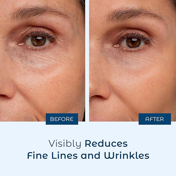 Cosmedica Hyaluronic Acid Serum for Skin – 4 Fl. Oz Hydrating Facial Moisturizer with Anti-Aging Skin Care Properties. Beauty and Skin Care