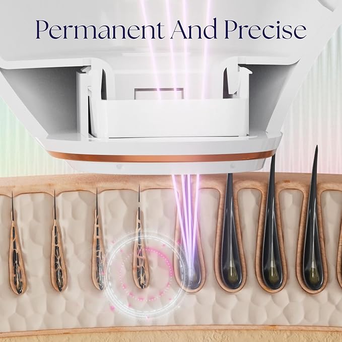 Epilaser At-Home Laser Hair Removal Device for Light Skin, Safe, Intelligent, Painless and Permanent Hair Removal for Face, Body, Bikini Line (Light Skin)