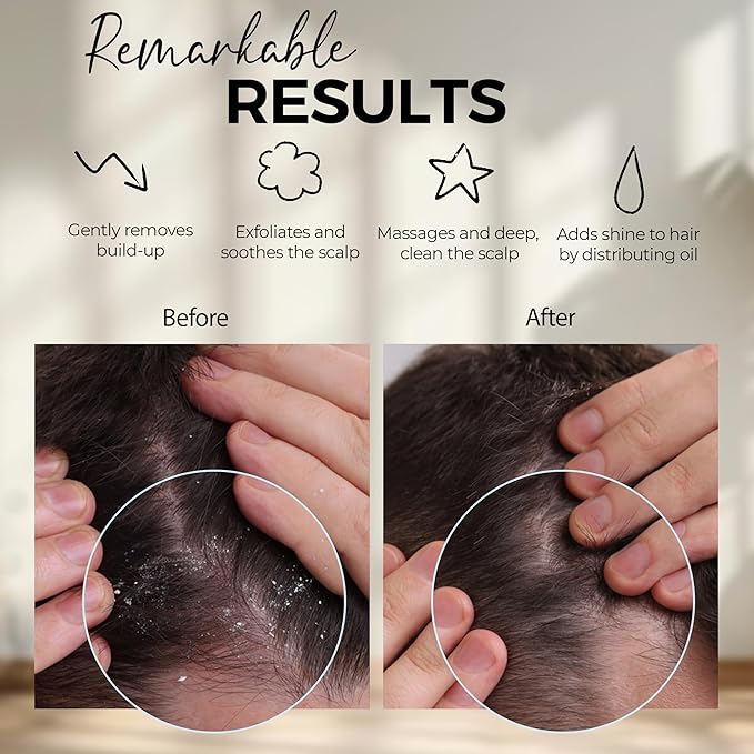 Fiora Naturals Scalp Massager Shampoo Brush - Silicon Scrubber & Exfoliator for Dandruff Removal and Hair Growth, Brush for Wet & Dry Hair, for Men, Women, Kids - BPA Free