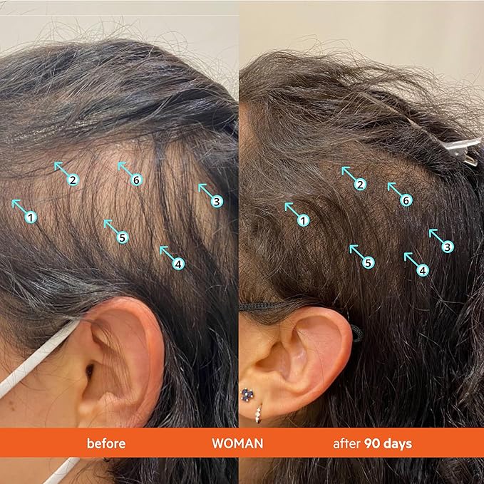 DS Labs Revita Shampoo and Conditioner – High-Performance Hair Density Shampoo & Conditioner, Volumizing & Thickening, Fuller, Healthier-Looking Hair, Sulfate & Silicone Free, For Men & Women, 205mL